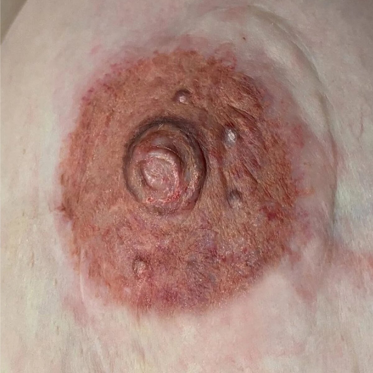 Close-up of a healed 3D areola tattoo showing realistic color, shading, and dimension achieved through advanced pigment technique.